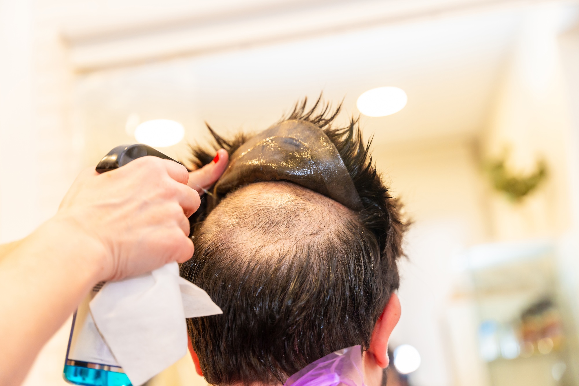 Hairdresser removing the capillary prosthesis of a client