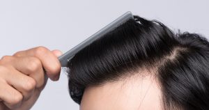 Complete Guide to Maintaining Hair Systems in Humid Weather