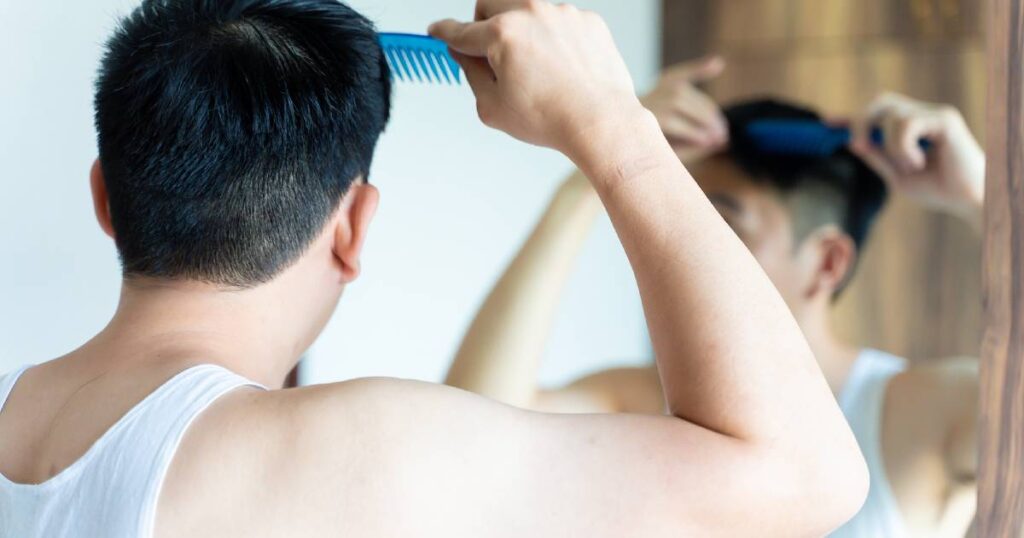 5 Questions to Ask Before Choosing Hair Replacement