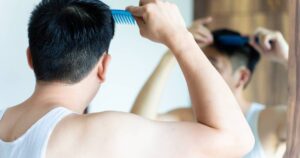 5 Questions to Ask Before Choosing Hair Replacement
